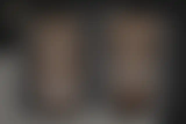 Photographie masquée d’un patient ClinMedica avant et après l’intervention