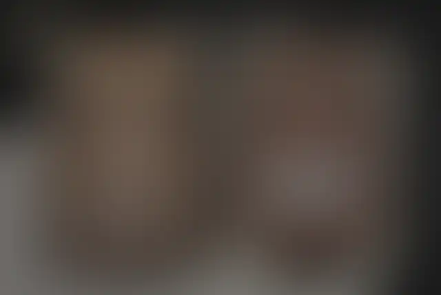 Photographie masquée d’un patient ClinMedica avant et après l’intervention