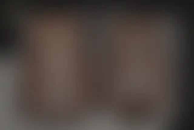 Photographie masquée d’un patient ClinMedica avant et après l’intervention