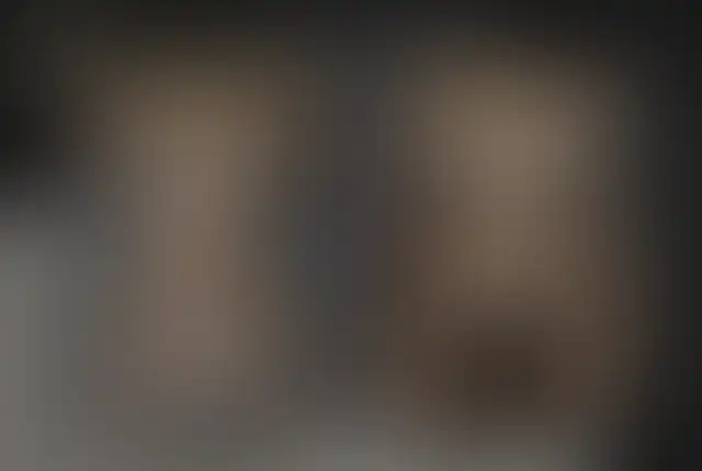 Photographie masquée d’un patient ClinMedica avant et après l’intervention