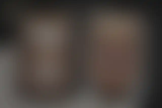 Photographie masquée d’un patient ClinMedica avant et après l’intervention