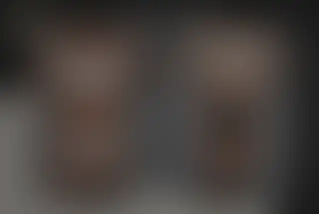 Photographie masquée d’un patient ClinMedica avant et après l’intervention