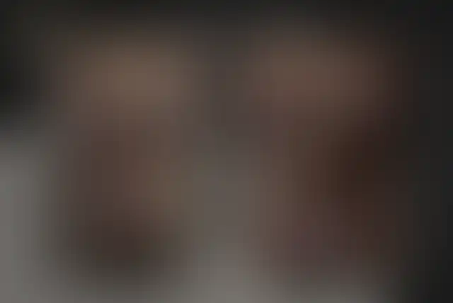 Photographie masquée d’un patient ClinMedica avant et après l’intervention