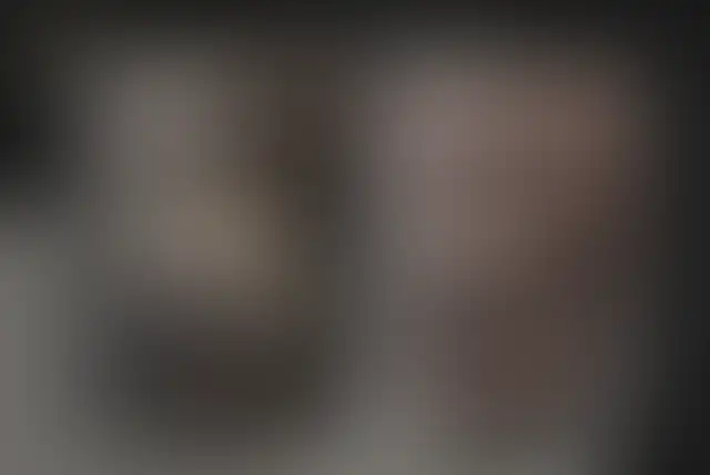Photographie masquée d’un patient ClinMedica avant et après l’intervention