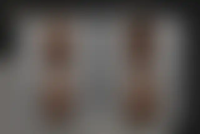 Fotografía cubierta de un paciente de ClinMedica antes y después de la cirugía
