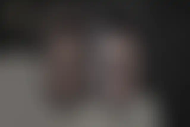 Fotografía cubierta de un paciente de ClinMedica antes y después de la cirugía