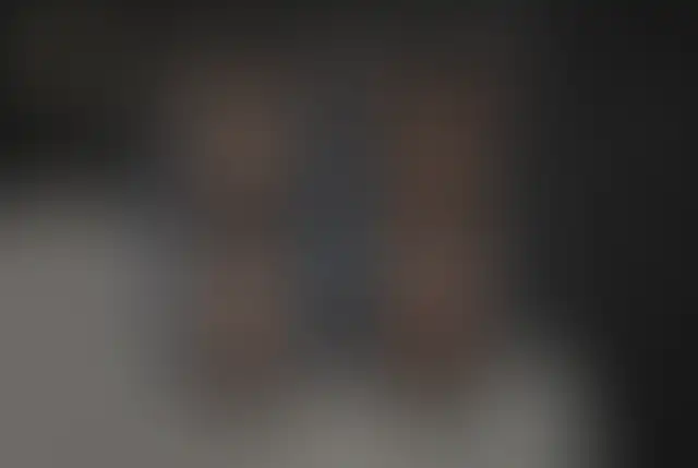 Fotografía cubierta de un paciente de ClinMedica antes y después de la cirugía