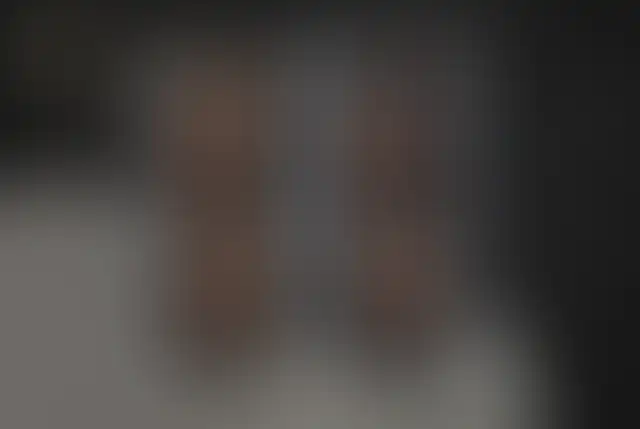 Fotografía cubierta de un paciente de ClinMedica antes y después de la cirugía