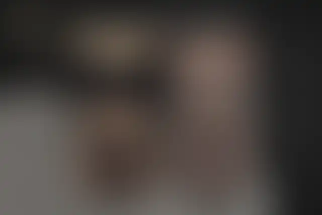 Fotografía cubierta de un paciente de ClinMedica antes y después de la cirugía