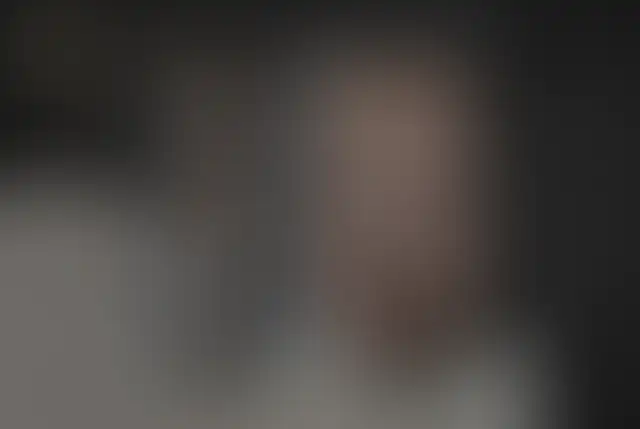 Fotografía cubierta de un paciente de ClinMedica antes y después de la cirugía