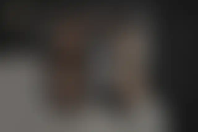 Fotografía cubierta de un paciente de ClinMedica antes y después de la cirugía