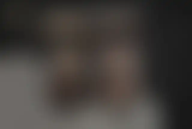 Fotografía cubierta de un paciente de ClinMedica antes y después de la cirugía