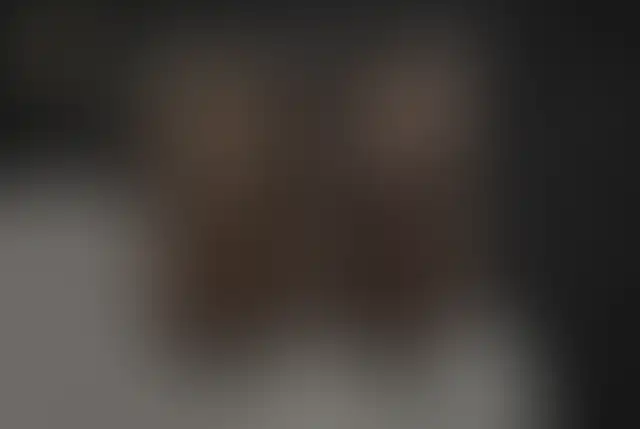 Fotografía cubierta de un paciente de ClinMedica antes y después de la cirugía