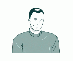 Que se passe-t-il après une greffe de cheveux ?