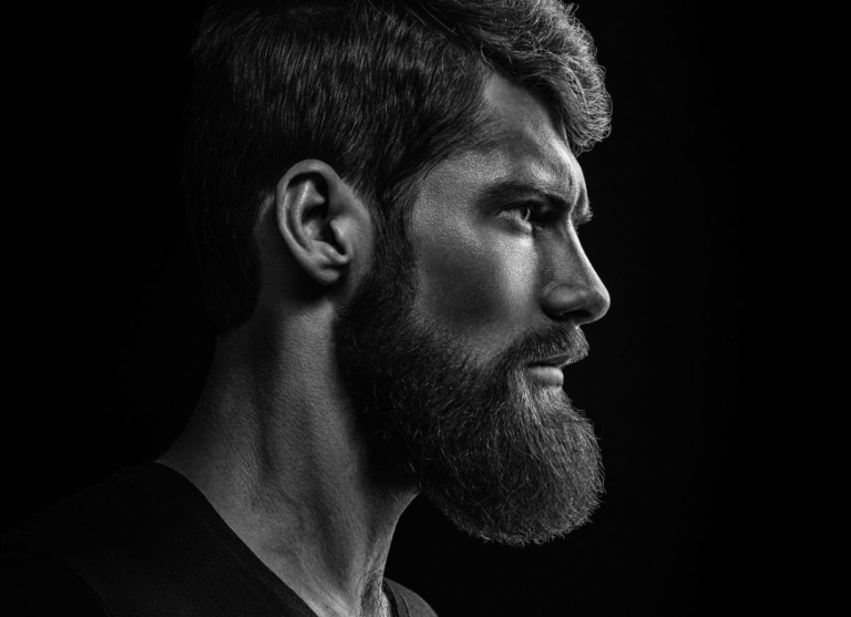 Patient after successful beard hair transplant in Turkey with visible natural growth with clinmedica