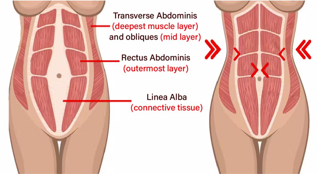 Abdominoplastia reloj de arena en Turquía