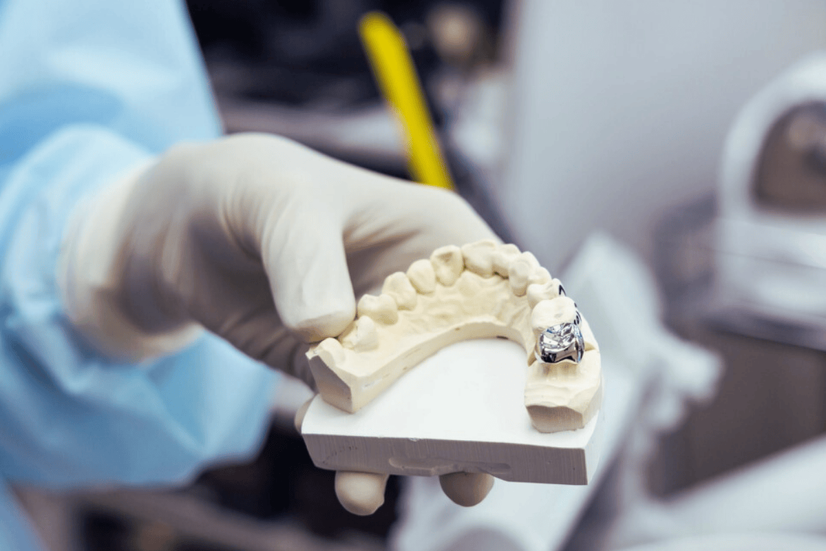 Dental Crowns