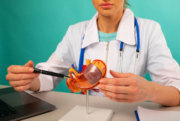 Gastric Bypass Surgery