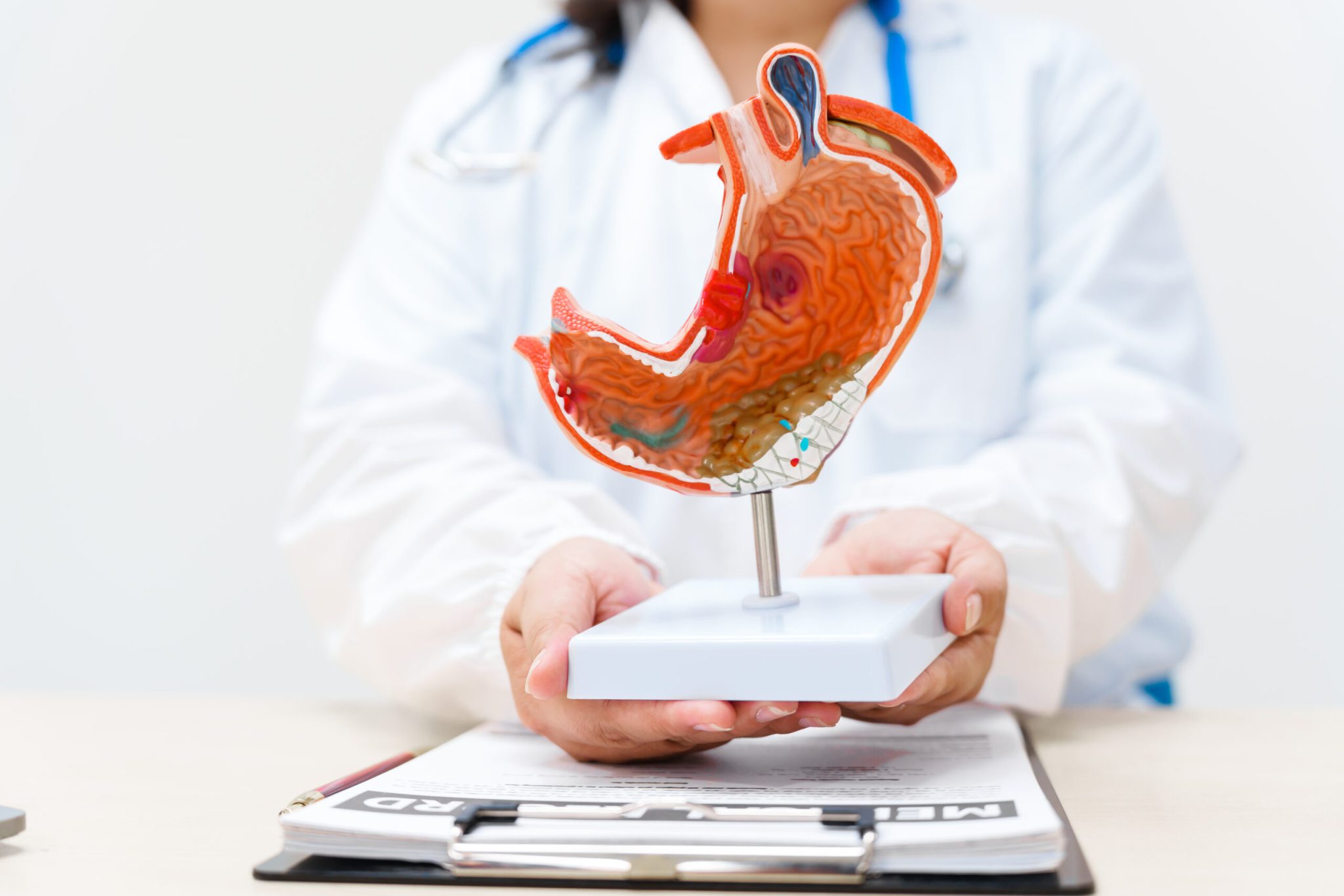 Post-Operative Diet After Sleeve Gastrectomy