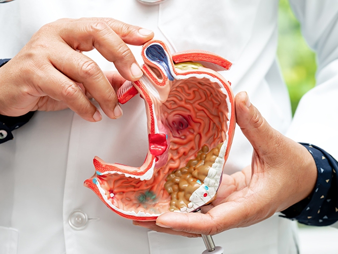 Obesity – Gastric Sleeve Surgery