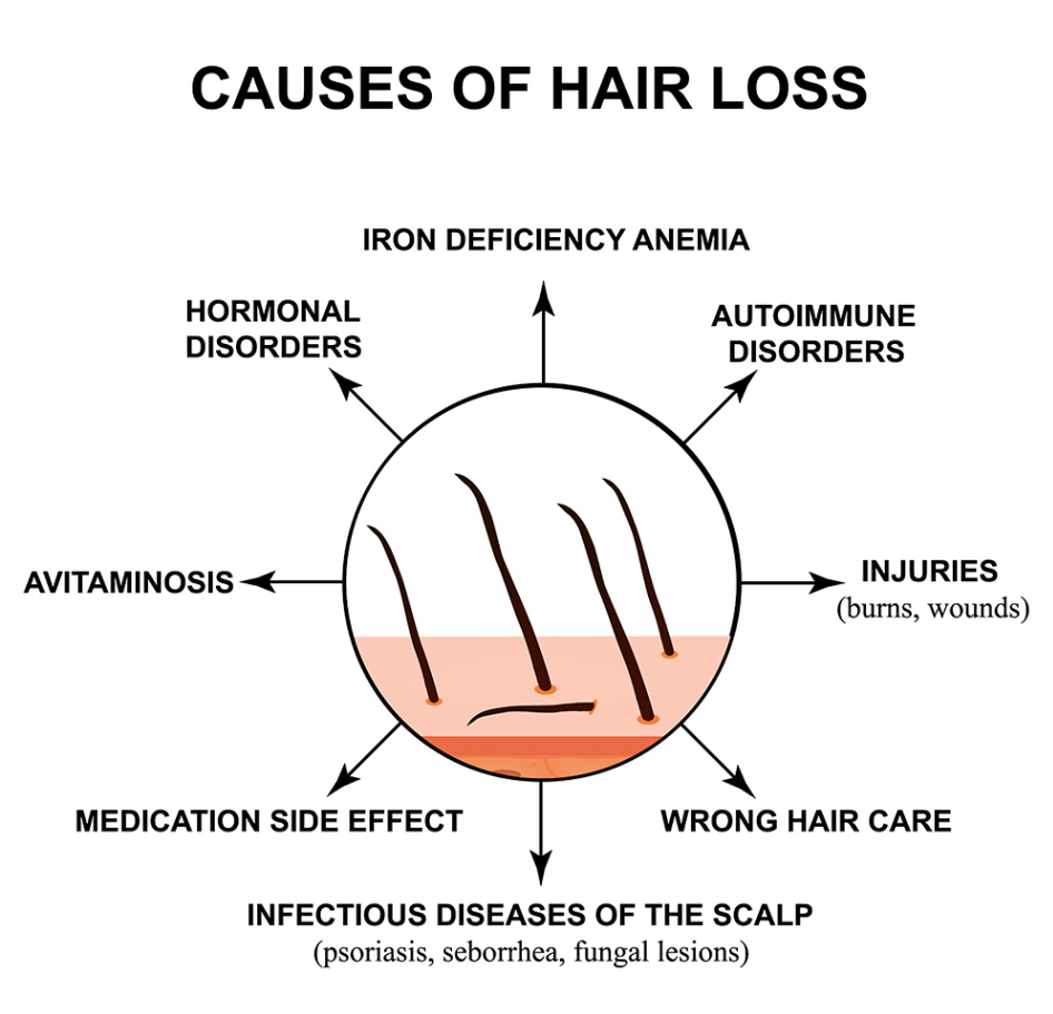 Cause della Caduta dei Capelli