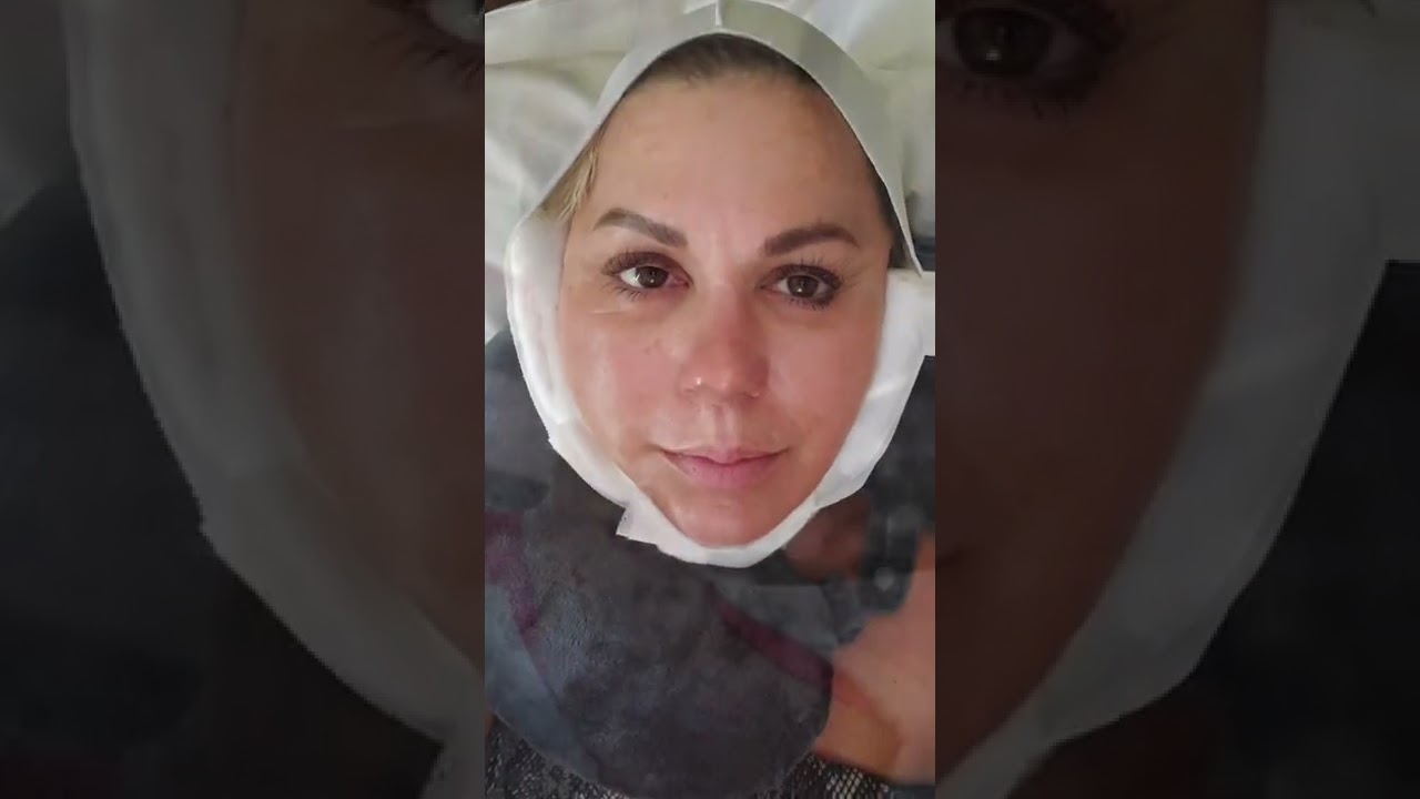 صورة مصغرة للفيديو: مريض مستلقٍ على وسادة ويرتدي ضمادة ضاغطة بيضاء تحيط بالرأس وأسفل الذقن